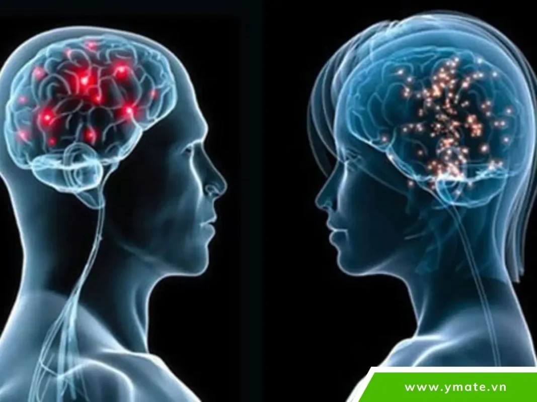Mánh khóe của bộ não