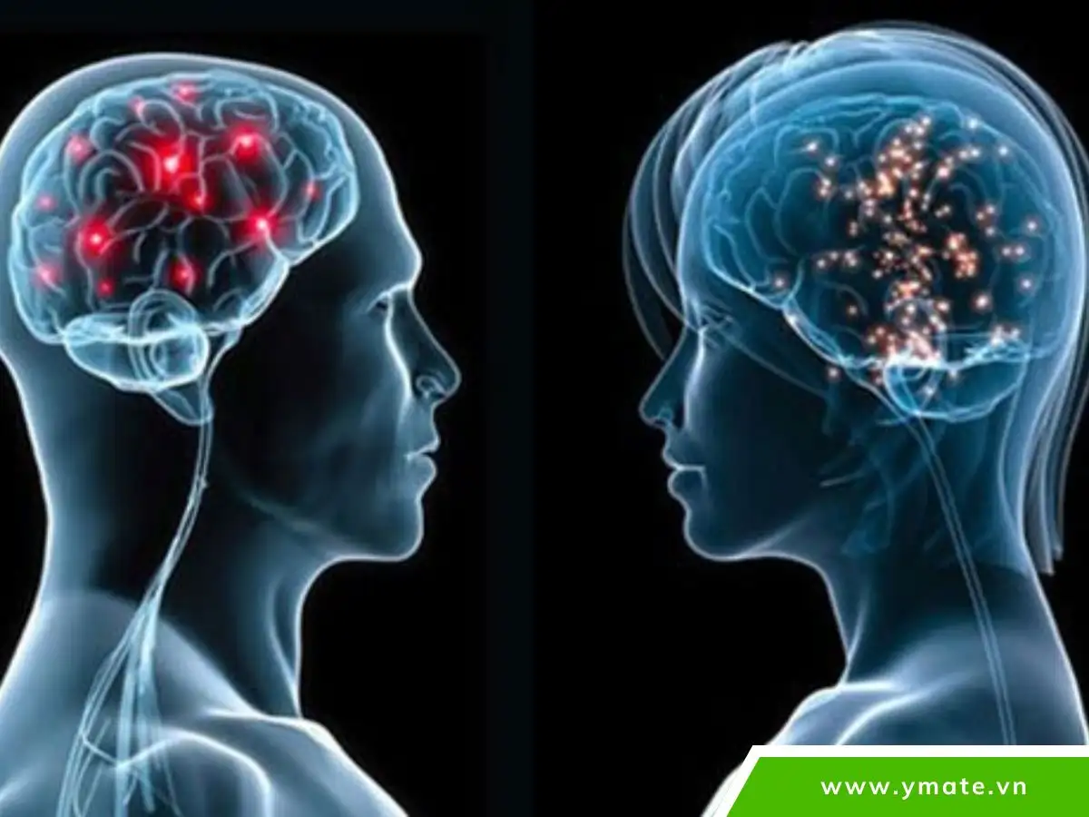 Mánh khóe của bộ não